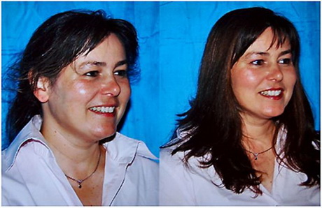voor-en-na-kapsels-43-18 Prije i poslije frizura