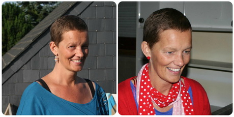 Kratke frizure nakon kemoterapije
