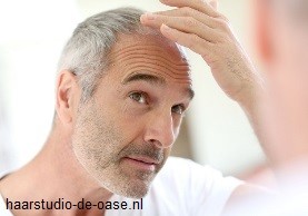 korte-kapsels-mannen-inhammen-82_17 Kratke frizure muški ulazi