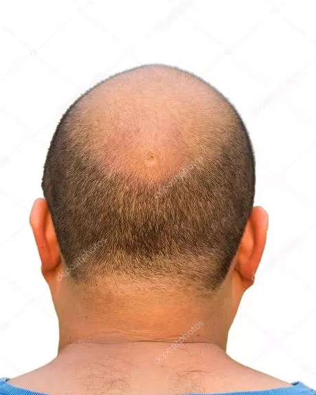 half-kaal-kapsel-man-56_5-14 Napola ćelav ošišan muškarac