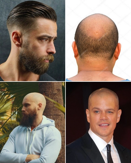 Napola ćelav ošišan muškarac