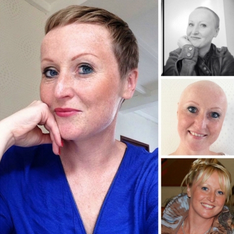 korte-kapsels-dames-na-chemo-69_11 Kratke frizure žena nakon kemoterapije