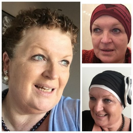 korte-kapsels-dames-na-chemo-69_12 Kratke frizure žena nakon kemoterapije