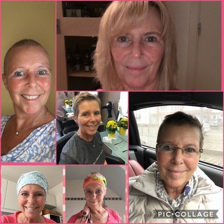korte-kapsels-dames-na-chemo-69_14 Kratke frizure žena nakon kemoterapije