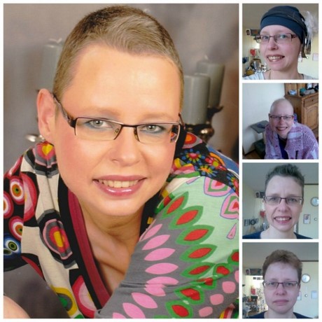 korte-kapsels-dames-na-chemo-69_6 Kratke frizure žena nakon kemoterapije