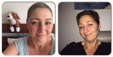 korte-kapsels-dames-na-chemo-69_8 Kratke frizure žena nakon kemoterapije