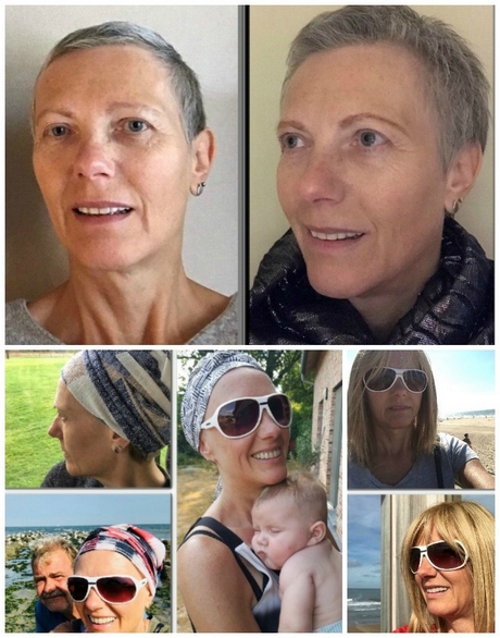 leuke-kapsels-na-chemo-41_11 Lijepe frizure nakon kemoterapije