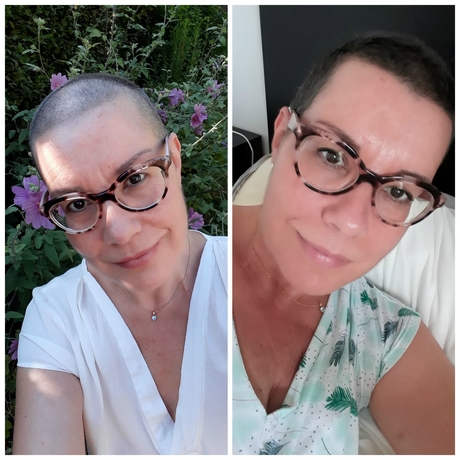 leuke-kapsels-na-chemo-41_13 Lijepe frizure nakon kemoterapije