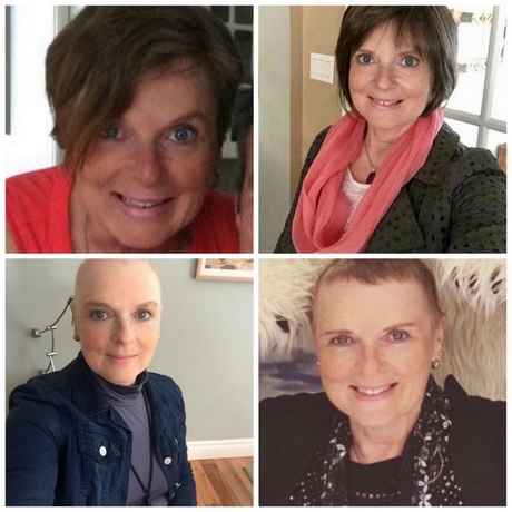 leuke-kapsels-na-chemo-41_16 Lijepe frizure nakon kemoterapije