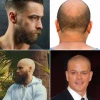 Napola ćelav ošišan muškarac